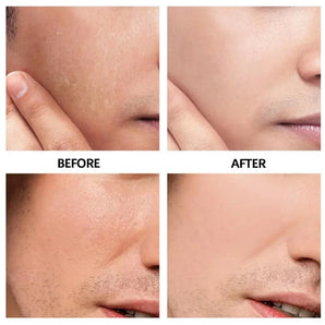 Men's Moisturizing Oil control Whitening Acne Cream